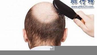 2024年脫發(fā)產(chǎn)品排行榜前十名 科學(xué)評(píng)測(cè)與選購(gòu)指南